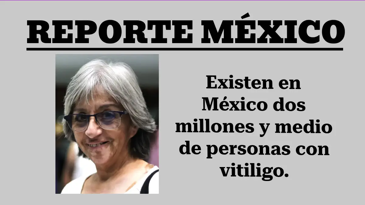 Existen en México dos millones y medio de personas con vitiligo.