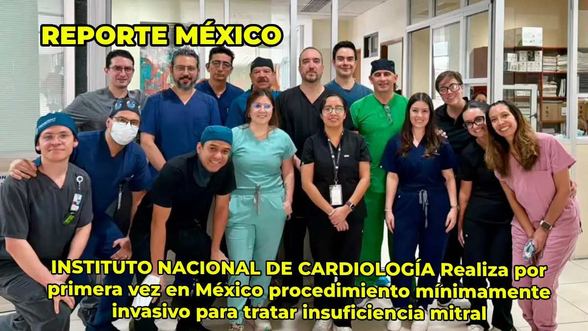 INSTITUTO NACIONAL DE CARDIOLOGÍA Realiza por primera vez en México procedimiento mínimamente invasivo para tratar insuficiencia mitral